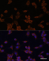 Immunofluorescence analysis of NIH/3T3 cells using HMGCR Polyclonal Antibody at dilution of 1:100. Blue: DAPI for nuclear staining.