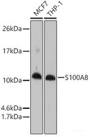 Western blot analysis of extracts of various cell lines using S100A8 Polyclonal Antibody at dilution of 1:1000.