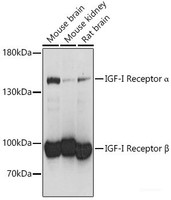 Western blot analysis of extracts of various cell lines using IGF1R Polyclonal Antibody at dilution of 1:1000.