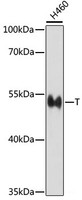 Western blot analysis of extracts of H460 cells using T Polyclonal Antibody at dilution of 1:1000.