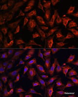 Immunofluorescence analysis of U2OS cells using MyD88 Polyclonal Antibody at dilution of 1:100. Blue: DAPI for nuclear staining.