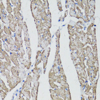 Immunohistochemistry of paraffin-embedded Rat heart using CD59 Polyclonal Antibody at dilution of 1:100 (40x lens) .