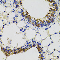 Immunohistochemistry of paraffin-embedded Mouse lung using CD59 Polyclonal Antibody