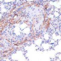 Immunohistochemistry of paraffin-embedded Mouse lung using COL1A1 Polyclonal Antibody at dilution of 1:200 (40x lens) .