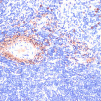 Immunohistochemistry of paraffin-embedded Mouse spleen using COL1A1 Polyclonal Antibody at dilution of 1:200 (40x lens) .