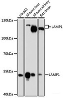 Western blot analysis of extracts of various cell lines using LAMP1 Polyclonal Antibody at dilution of 1:1000.