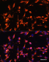 Immunofluorescence analysis of NIH/3T3 cells using LAMP1 Polyclonal Antibody at dilution of 1:100. Blue: DAPI for nuclear staining.