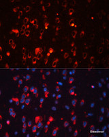 Immunofluorescence analysis of Mouse brain using KCNA1 Polyclonal Antibody at dilution of 1:100. Blue: DAPI for nuclear staining.