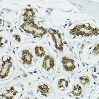 Immunohistochemistry of paraffin-embedded Human breast using Lamin B1 Polyclonal Antibody at dilution of 1:200 (40x lens) .