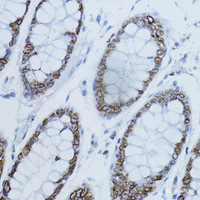 Immunohistochemistry of paraffin-embedded Human colon using LMNB1 Polyclonal Antibody at dilution of 1:200 (40x lens) .