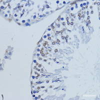 Immunohistochemistry of paraffin-embedded Rat testis using LMNB1 Polyclonal Antibody at dilution of 1:200 (40x lens) .