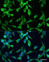 Immunofluorescence analysis of NIH-3T3 cells using SMAD2 Polyclonal Antibody at dilution of 1:100. Blue: DAPI for nuclear staining.