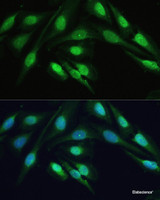 Immunofluorescence analysis of U-2 OS cells using SMAD2 Polyclonal Antibody at dilution of 1:100. Blue: DAPI for nuclear staining.