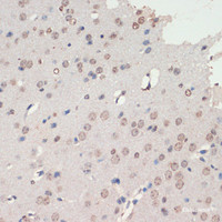 Immunohistochemistry of paraffin-embedded Mouse brain using NEUROD1 Polyclonal Antibody at dilution of 1:200 (40x lens) .