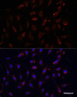 Immunofluorescence analysis of C6 cells using NFKBIA Polyclonal Antibody at dilution of 1:100. Blue: DAPI for nuclear staining.