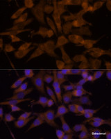 Immunofluorescence analysis of HeLa cells using UGT2B7 Polyclonal Antibody at dilution of 1:100 (40x lens) . Blue: DAPI for nuclear staining.