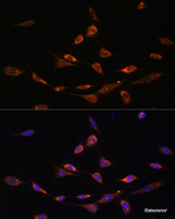 Immunofluorescence analysis of NIH-3T3 cells using PAK3 Polyclonal Antibody at dilution of 1:100. Blue: DAPI for nuclear staining.