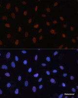 Immunofluorescence analysis of U-2 OS cells using Rb Polyclonal Antibody at dilution of 1:100. Blue: DAPI for nuclear staining.