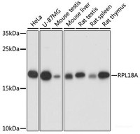 Western blot analysis of extracts of various cell lines using RPL18A Polyclonal Antibody at dilution of 1:1000.