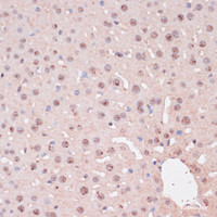 Immunohistochemistry of paraffin-embedded Mouse liver using ZEB1 Polyclonal Antibody at dilution of 1:100 (40x lens) .