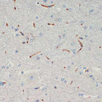 Immunohistochemistry of paraffin-embedded Mouse spinal cord using THBS1 Polyclonal Antibody at dilution of 1:200 (40x lens) .