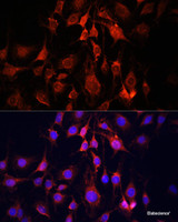 Immunofluorescence analysis of C6 cells using UCP3 Polyclonal Antibody at dilution of 1:100. Blue: DAPI for nuclear staining.