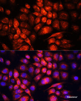 Immunofluorescence analysis of HeLa cells using UCP3 Polyclonal Antibody at dilution of 1:100. Blue: DAPI for nuclear staining.