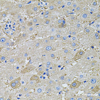Immunohistochemistry of paraffin-embedded Human liver using GLA Polyclonal Antibody at dilution of 1:100 (40x lens) .