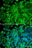 Immunofluorescence analysis of HeLa cells using GLA Polyclonal Antibody