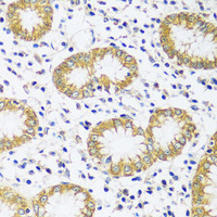 Immunohistochemistry of paraffin-embedded Human stomach using CADPS Polyclonal Antibody at dilution of 1:100 (40x lens) .