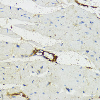 Immunohistochemistry of paraffin-embedded Mouse heart using Complement Factor B Polyclonal Antibody at dilution of 1:200 (40x lens) .