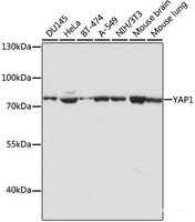 Western blot analysis of extracts of various cell lines using YAP1 Polyclonal Antibody at dilution of 1:1000.