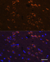 Immunofluorescence analysis of Mouse brain using P2RY12 Polyclonal Antibody at dilution of 1:100. Blue: DAPI for nuclear staining.