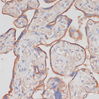 Immunohistochemistry of paraffin-embedded Human placenta using NCSTN Polyclonal Antibody at dilution of 1:100 (40x lens) .