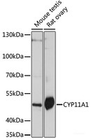 Western blot analysis of extracts of various cell lines using CYP11A1 Polyclonal Antibody at dilution of 1:1000.