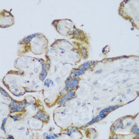 Immunohistochemistry of paraffin-embedded Human placenta using CYP11A1 Polyclonal Antibody at dilution of 1:150 (40x lens) .