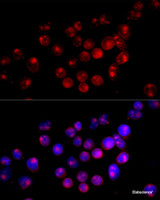 Immunofluorescence analysis of HeLa cells using CYP27B1 Polyclonal Antibody at dilution of 1:100 (40x lens) . Blue: DAPI for nuclear staining.