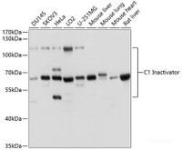 Western blot analysis of extracts of various cell lines using C1 Inactivator Polyclonal Antibody at dilution of 1:1000.