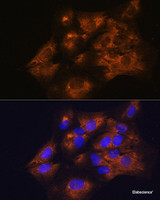 Immunofluorescence analysis of C6 cells using C1 Inactivator Polyclonal Antibody at dilution of 1:100. Blue: DAPI for nuclear staining.