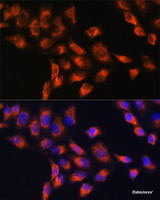 Immunofluorescence analysis of HeLa cells using C1 Inactivator Polyclonal Antibody at dilution of 1:100. Blue: DAPI for nuclear staining.