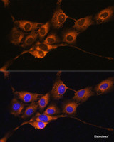 Immunofluorescence analysis of NIH/3T3 cells using C1 Inactivator Polyclonal Antibody at dilution of 1:100. Blue: DAPI for nuclear staining.