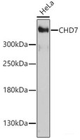 Western blot analysis of extracts of HeLa cells using CHD7 Polyclonal Antibody at dilution of 1:1000.