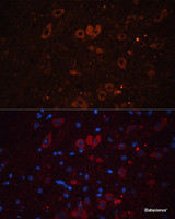 Immunofluorescence analysis of Mouse brain using SLC17A7 Polyclonal Antibody at dilution of 1:100. Blue: DAPI for nuclear staining.
