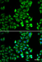 Immunofluorescence analysis of HeLa cells using DRD5 Polyclonal Antibody