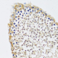 Immunohistochemistry of paraffin-embedded Rat testis using C12orf10 Polyclonal Antibody at dilution of 1:100 (40x lens) .