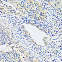 Immunohistochemistry of paraffin-embedded Rat ovary using C12orf10 Polyclonal Antibody at dilution of 1:100 (40x lens) .