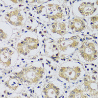 Immunohistochemistry of paraffin-embedded Human stomach using C12orf10 Polyclonal Antibody at dilution of 1:100 (40x lens) .