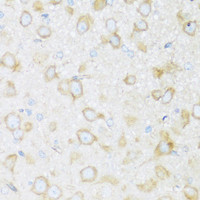 Immunohistochemistry of paraffin-embedded Rat brain using BRSK1 Polyclonal Antibody at dilution of 1:100 (40x lens) .
