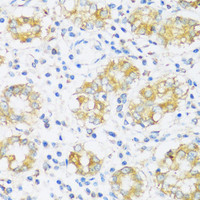 Immunohistochemistry of paraffin-embedded Human stomach using BRSK1 Polyclonal Antibody at dilution of 1:100 (40x lens) .