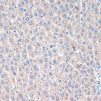 Immunohistochemistry of paraffin-embedded Rat liver using LRRK2 Polyclonal Antibody at dilution of 1:200 (40x lens) .